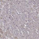 Tomosyn Antibody in Immunohistochemistry (IHC)