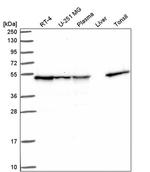 DNAJA2 Antibody in Western Blot (WB)