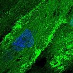 FMN2 Antibody in Immunocytochemistry (ICC/IF)