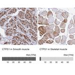 CTPS Antibody in Immunohistochemistry (IHC)