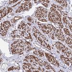 CTPS Antibody in Immunohistochemistry (IHC)