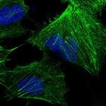 CTPS Antibody in Immunocytochemistry (ICC/IF)