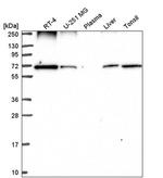 Ribophorin I Antibody in Western Blot (WB)