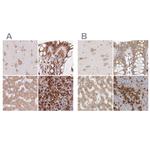 Ribophorin I Antibody in Immunohistochemistry (IHC)