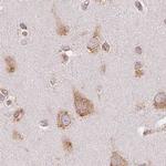 Ribophorin I Antibody in Immunohistochemistry (IHC)