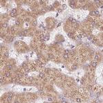 Ribophorin I Antibody in Immunohistochemistry (IHC)