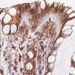 Ribophorin I Antibody in Immunohistochemistry (IHC)