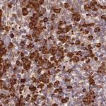 Ribophorin I Antibody in Immunohistochemistry (IHC)