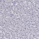 QRICH2 Antibody in Immunohistochemistry (Paraffin) (IHC (P))