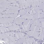 QRICH2 Antibody in Immunohistochemistry (Paraffin) (IHC (P))