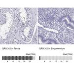 QRICH2 Antibody in Immunohistochemistry (IHC)