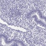 QRICH2 Antibody in Immunohistochemistry (IHC)