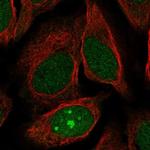 JRK Antibody in Immunocytochemistry (ICC/IF)