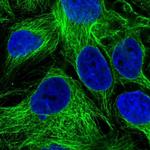 PMAT Antibody in Immunocytochemistry (ICC/IF)