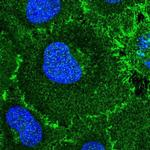 ROBO1 Antibody in Immunocytochemistry (ICC/IF)