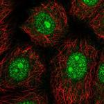 NARF Antibody in Immunocytochemistry (ICC/IF)