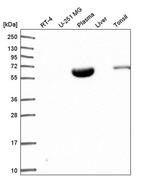 NARF Antibody in Western Blot (WB)