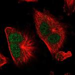 TSR1 Antibody in Immunocytochemistry (ICC/IF)