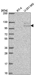 TSR1 Antibody in Western Blot (WB)