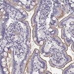 MYO1A Antibody in Immunohistochemistry (IHC)