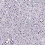 MYO1A Antibody in Immunohistochemistry (IHC)