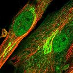 ENPP2 Antibody in Immunocytochemistry (ICC/IF)