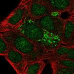 DHRS2 Antibody in Immunocytochemistry (ICC/IF)