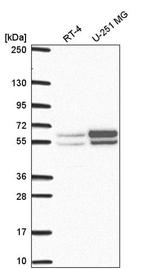 NAP1L2 Antibody in Western Blot (WB)