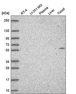 GLD2 Antibody in Western Blot (WB)