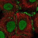 Connexin 30.3 Antibody in Immunocytochemistry (ICC/IF)