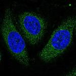 ASPH Antibody in Immunocytochemistry (ICC/IF)