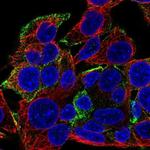 KANK1 Antibody in Immunocytochemistry (ICC/IF)