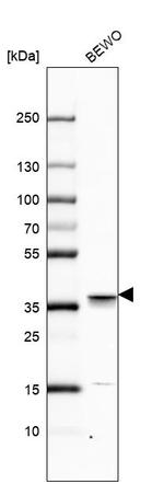 NUP37 Antibody in Western Blot (WB)