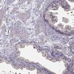 PKP2 Antibody in Immunohistochemistry (Paraffin) (IHC (P))