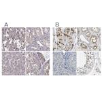 PKP2 Antibody in Immunohistochemistry (IHC)