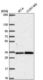 Gemin 2 Antibody in Western Blot (WB)