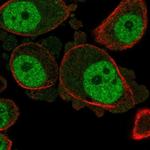 KCNN3 Antibody in Immunocytochemistry (ICC/IF)