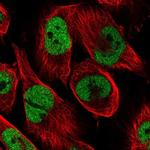 CAD Antibody in Immunocytochemistry (ICC/IF)