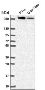 CAD Antibody in Western Blot (WB)