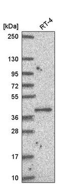 PUS1 Antibody in Western Blot (WB)