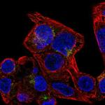 SLC29A3 Antibody in Immunocytochemistry (ICC/IF)