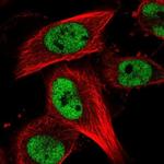 RBM15B Antibody in Immunocytochemistry (ICC/IF)