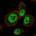 MAPKAPK3 Antibody in Immunocytochemistry (ICC/IF)