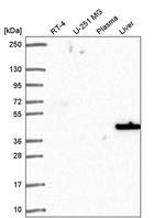 SLC14A1 Antibody in Western Blot (WB)