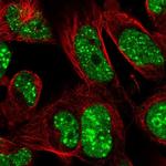 RNF169 Antibody in Immunocytochemistry (ICC/IF)