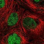 DIS3 Antibody in Immunocytochemistry (ICC/IF)