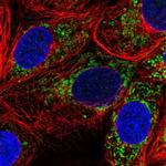 Pyruvate Carboxylase Antibody in Immunocytochemistry (ICC/IF)