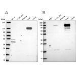 Pyruvate Carboxylase Antibody in Western Blot (WB)