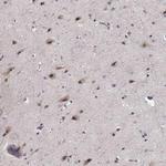 TESPA1 Antibody in Immunohistochemistry (IHC)