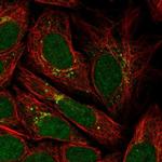 PPP2R3C Antibody in Immunocytochemistry (ICC/IF)